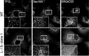 Image showing how loss of TANGO1 expression affects the ERGIC